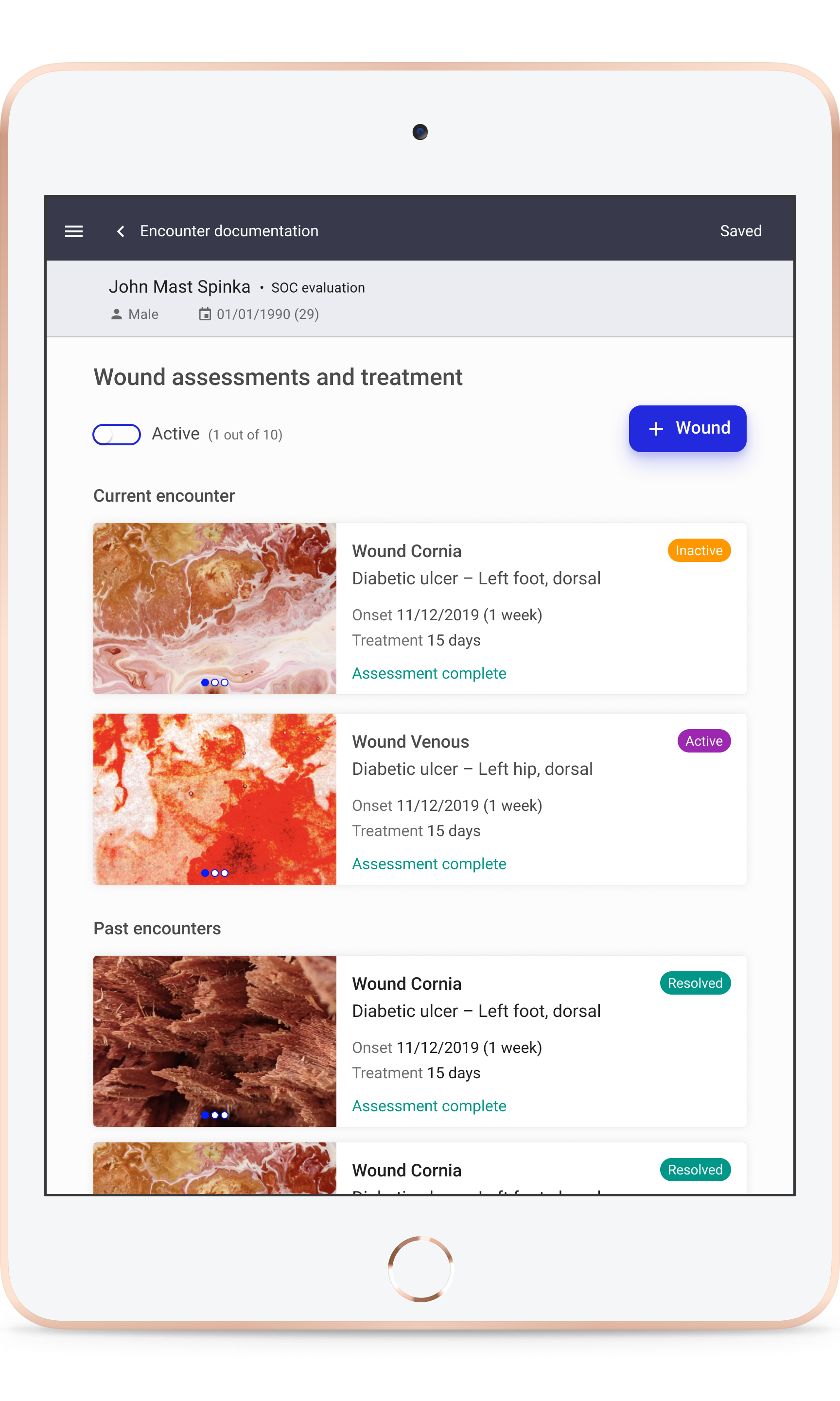 Wound page2